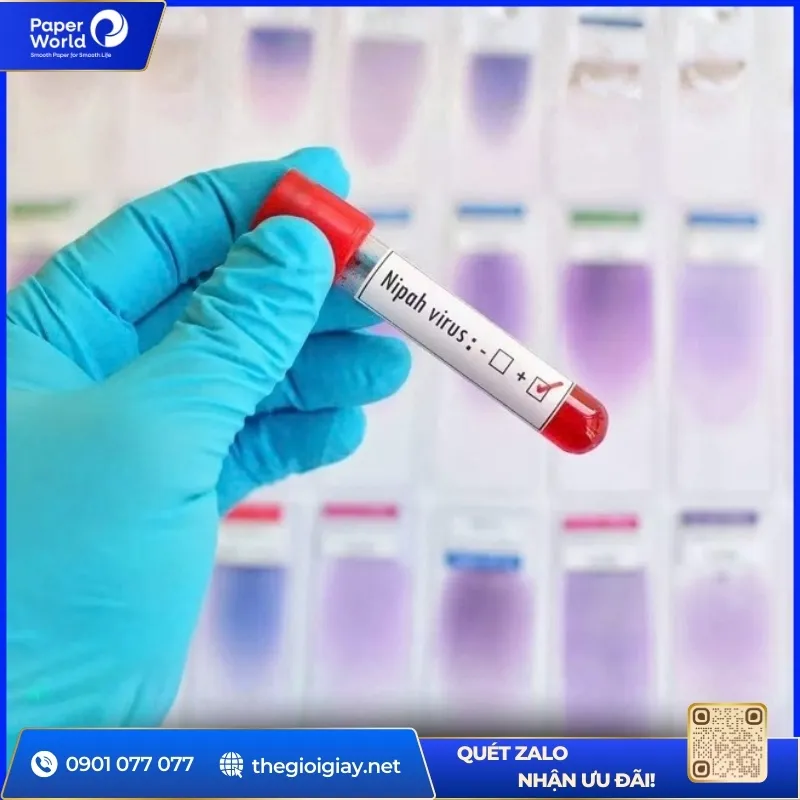 Khi nghi ngờ bị nhiễm vi rút Nipah, cần đến cơ sở y tế ngay