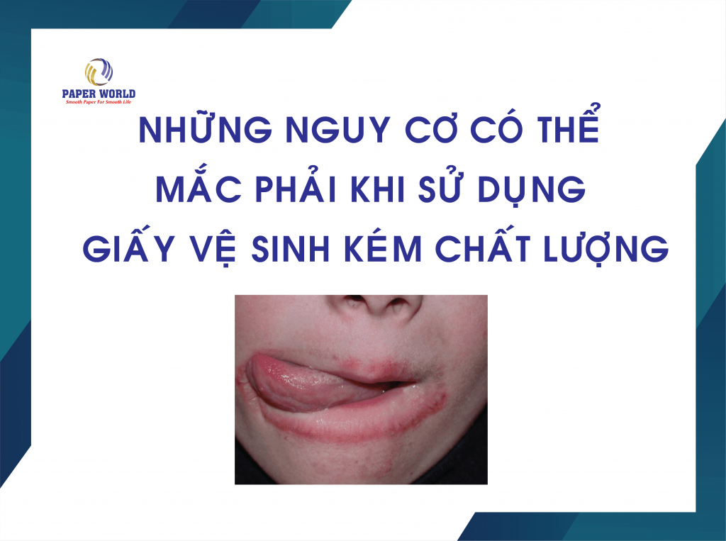 Những Nguy Cơ Có Thể Mắc Phải Khi Sử DỤNG Giấy Vệ Sinh Kém Chất Lượng